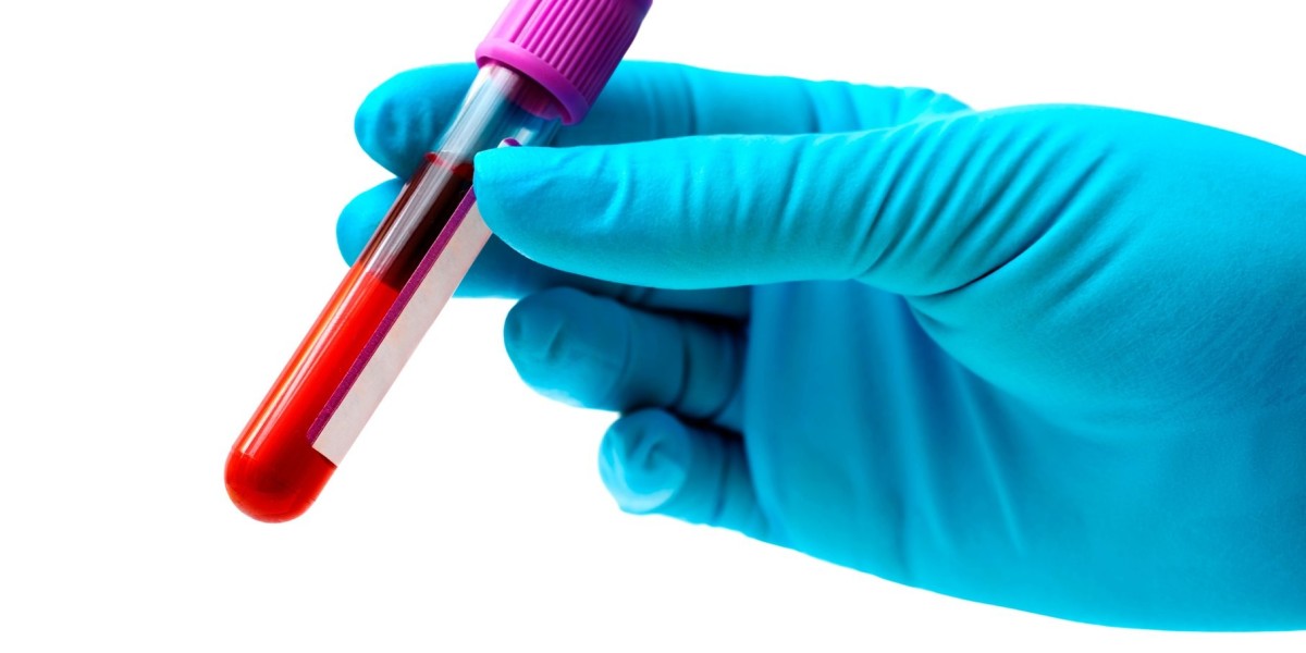 Common Blood Tests Done on Dogs